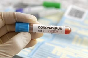 Barbados: 37 new cases of COVID-19, 8 Recoveries